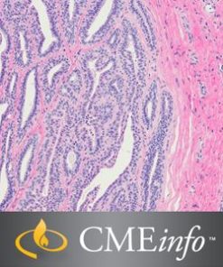 Gynecologic Pathology Masters of Pathology Series 2020 (CME VIDEOS)