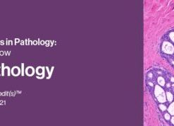 2021 Classic Lectures in Pathology: What You Need to Know: Breast Pathology (CME VIDEOS)