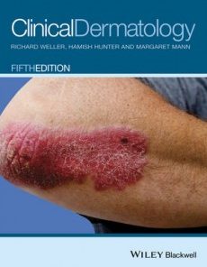 Clinical Dermatology, 5th Edition