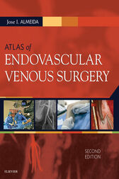 Atlas of Endovascular Venous Surgery, 2nd Edition (Videos, Organized)