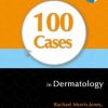 100 Cases in Dermatology