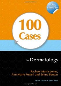 100 Cases in Dermatology