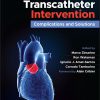 Aortic Valve Transcatheter Intervention Complications and Solutions (PDF)