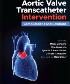 Aortic Valve Transcatheter Intervention Complications and Solutions (PDF)