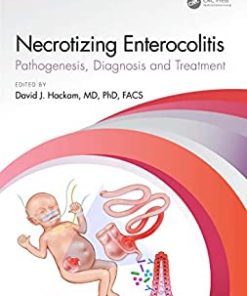 Necrotizing Enterocolitis: pathogenesis, diagnosis and treatment (PDF)