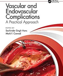 Vascular and Endovascular Complications: A Practical Approach (PDF)