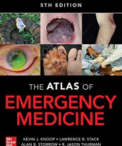 Atlas of Emergency Medicine, 5th Edition (EPUB)