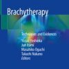 Brachytherapy: Techniques and Evidences