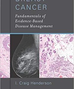 Breast Cancer: Fundamentals of Evidence-Based Disease Management 1st Edition