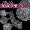 Breast Tomosynthesis 1st Edition