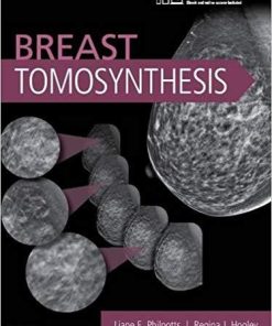 Breast Tomosynthesis 1st Edition