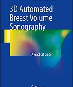 3D Automated Breast Volume Sonography: A Practical Guide 1st ed. 2017 Edition