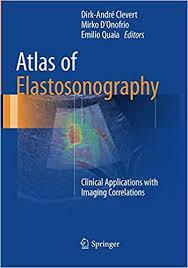 Atlas of Elastosonography: Clinical Applications with Imaging Correlations 1st ed. 2017 Edition