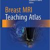 Breast MRI Teaching Atlas 1st ed. 2017 Edition