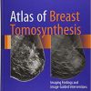 Atlas of Breast Tomosynthesis: Imaging Findings and Image-Guided Interventions 1st ed. 2017 Edition