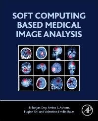 Soft Computing Based Medical Image Analysis 1st Edition