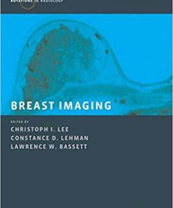 Breast Imaging (Rotations in Radiology) 1st Edition