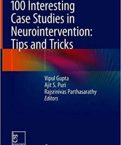 100 Interesting Case Studies in Neurointervention: Tips and Tricks 1st ed. 2019 Edition