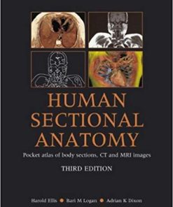 Human Sectional Anatomy: Atlas of Body Sections, CT and MRI Images 3rd Edition