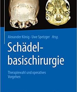 Schädelbasischirurgie: Therapiewahl und operatives Vorgehen (German Edition)