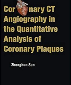 Coronary CT Angiography in the Quantitative Analysis of Coronary Plaques 1st Edition