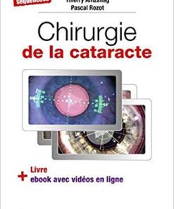 Chirurgie De La Cataracte: 60 Videos Sequencees (French Edition) (French)