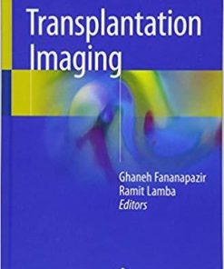 Transplantation Imaging 1st ed. 2018 Edition