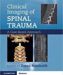 Clinical Imaging of Spinal Trauma: A Case-Based Approach 1st Edition