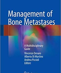 Management of Bone Metastases: A Multidisciplinary Guide 1st ed. 2019 Edition