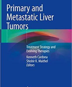 Primary and Metastatic Liver Tumors: Treatment Strategy and Evolving Therapies 1st ed. 2018 Edition