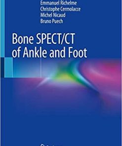 Bone SPECT/CT of Ankle and Foot