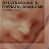 3D Ultrasound in Prenatal Diagnosis: A Practical Approach 1st Edition