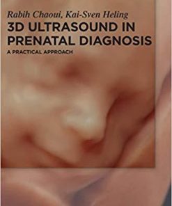 3D Ultrasound in Prenatal Diagnosis: A Practical Approach 1st Edition