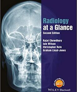 Radiology at a Glance 2nd Edition