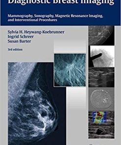 Diagnostic Breast Imaging: Mammography, Sonography, Magnetic Resonance Imaging and Interventional Procedures 3rd Edition