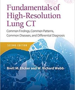 Fundamentals of High-Resolution Lung CT: Common Findings, Common Patterns, Common Diseases and Differential Diagnosis (Pocket Notebook) Second Edition