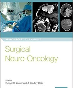 Surgical Neuro-Oncology (Neurosurgery by Example) 1st Edition