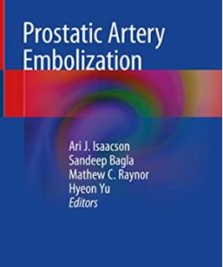 Prostatic Artery Embolization (English Edition)