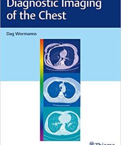 Diagnostic Imaging of the Chest 1st Edición