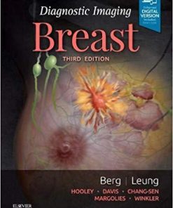 Breast (Diagnostic Imaging) 3rd Edition