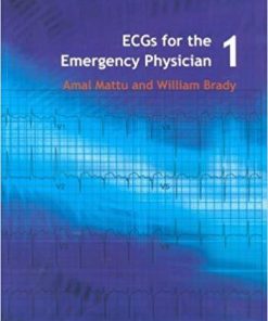 ECG’s for the Emergency Physician 1 1st Edition