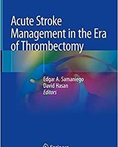 Acute Stroke Management in the Era of Thrombectomy 1st ed. 2019 Edition