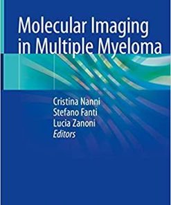 Molecular Imaging in Multiple Myeloma 1st ed. 2019 Edition