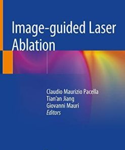 Image-guided Laser Ablation 1st ed. 2020 Edition