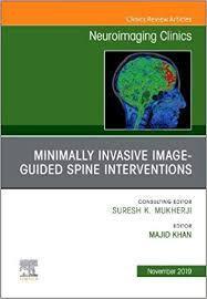 Spine Intervention, An Issue of Neuroimaging Clinics of North America (The Clinics: Radiology) 1st Edition