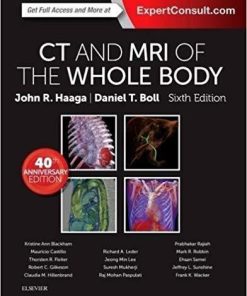 CT and MRI of the Whole Body, 2-Volume Set 6th Edition