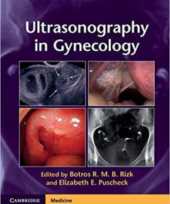 Ultrasonography in Gynecology 1st Edition