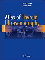 Atlas of Thyroid Ultrasonography 1st ed. 2017 Edition