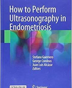 How to Perform Ultrasonography in Endometriosis 1st ed. 2018 Edition