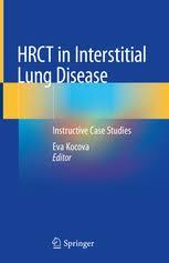 HRCT in Interstitial Lung Disease: Instructive Case Studies 1st ed. 2019 Edition